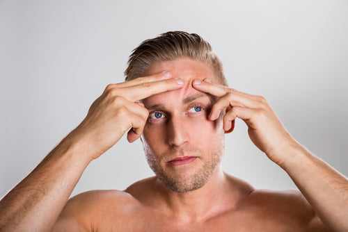 man squeezing pimple man squeezing pimple